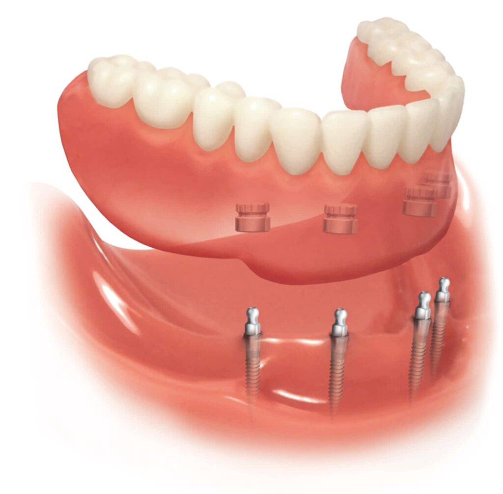 dundas-denture-clinic-1.jpg