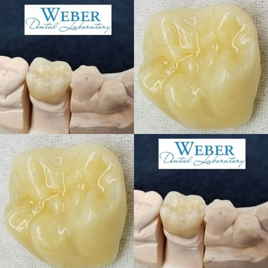 weber-dental-laboratory-1.jpg