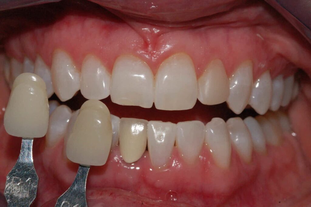 Abby Dental Care