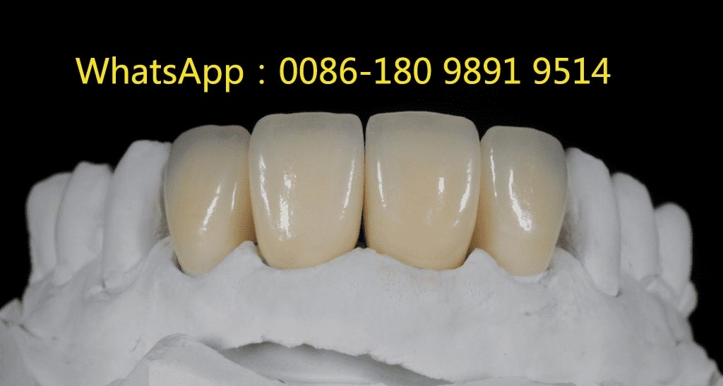 fd864176-ad3c-482b-96cd-8211e8b6039f.jpg