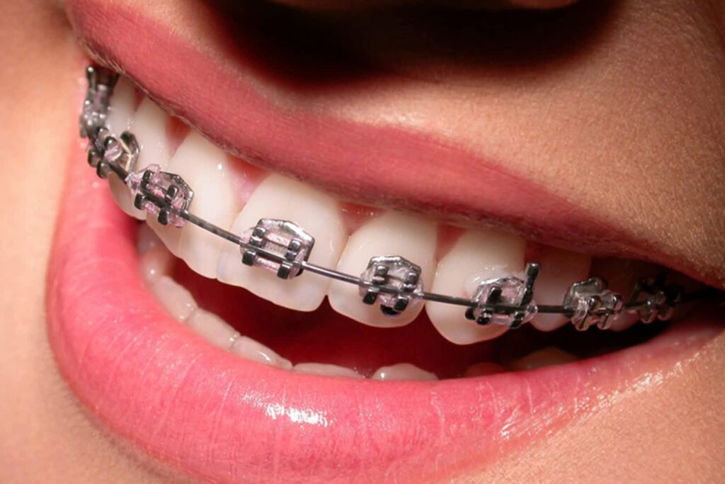 GD Orthodontics