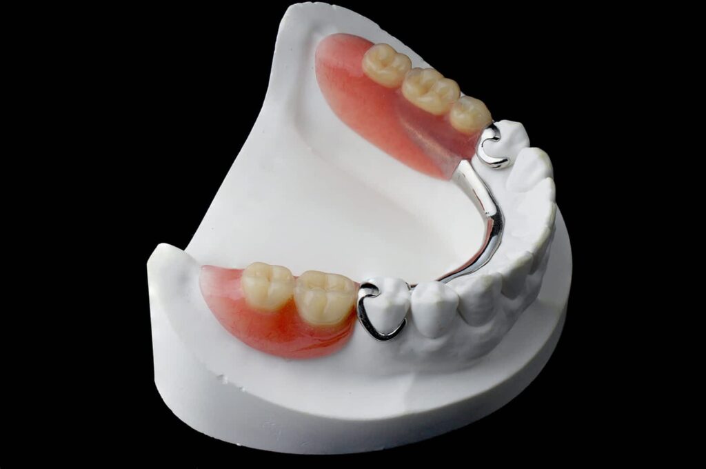 harbour-city-denture-1.jpg