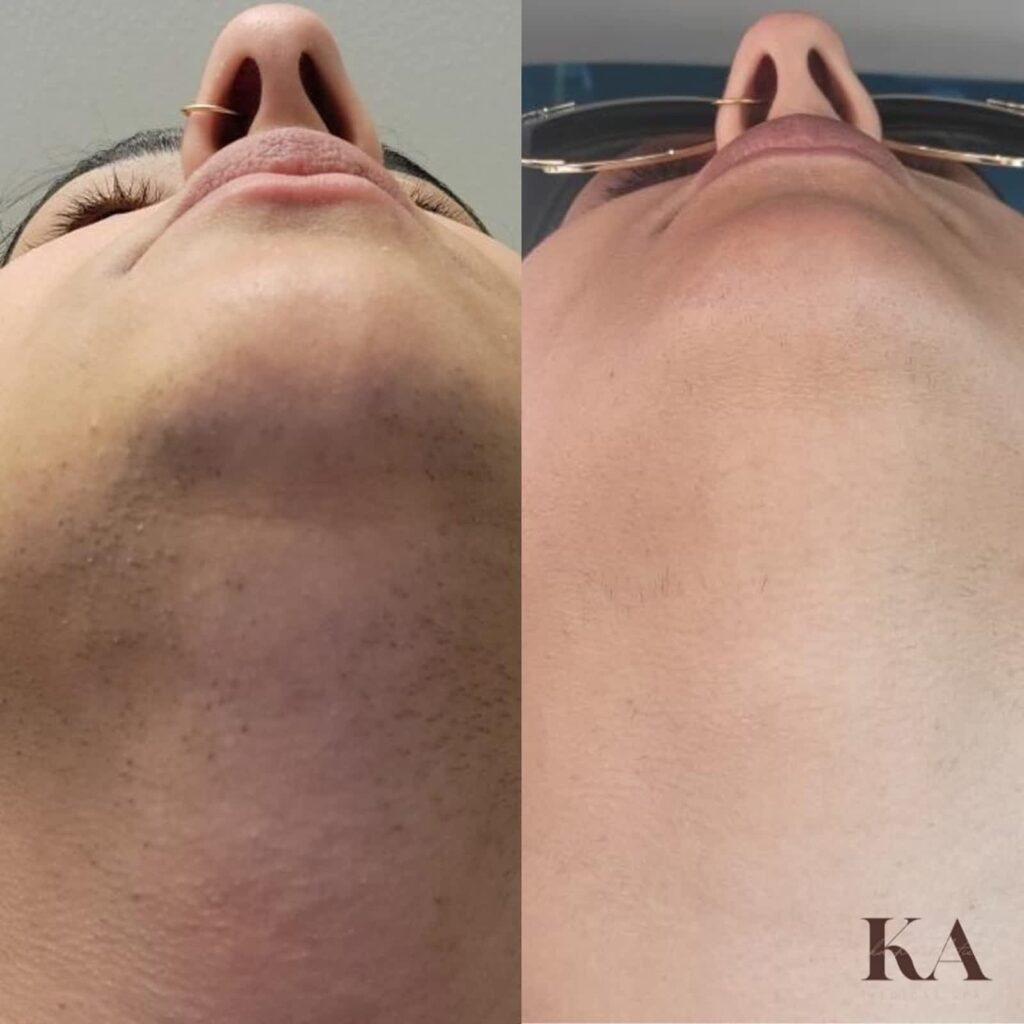kash-aesthetics-medical-spa-1.jpg