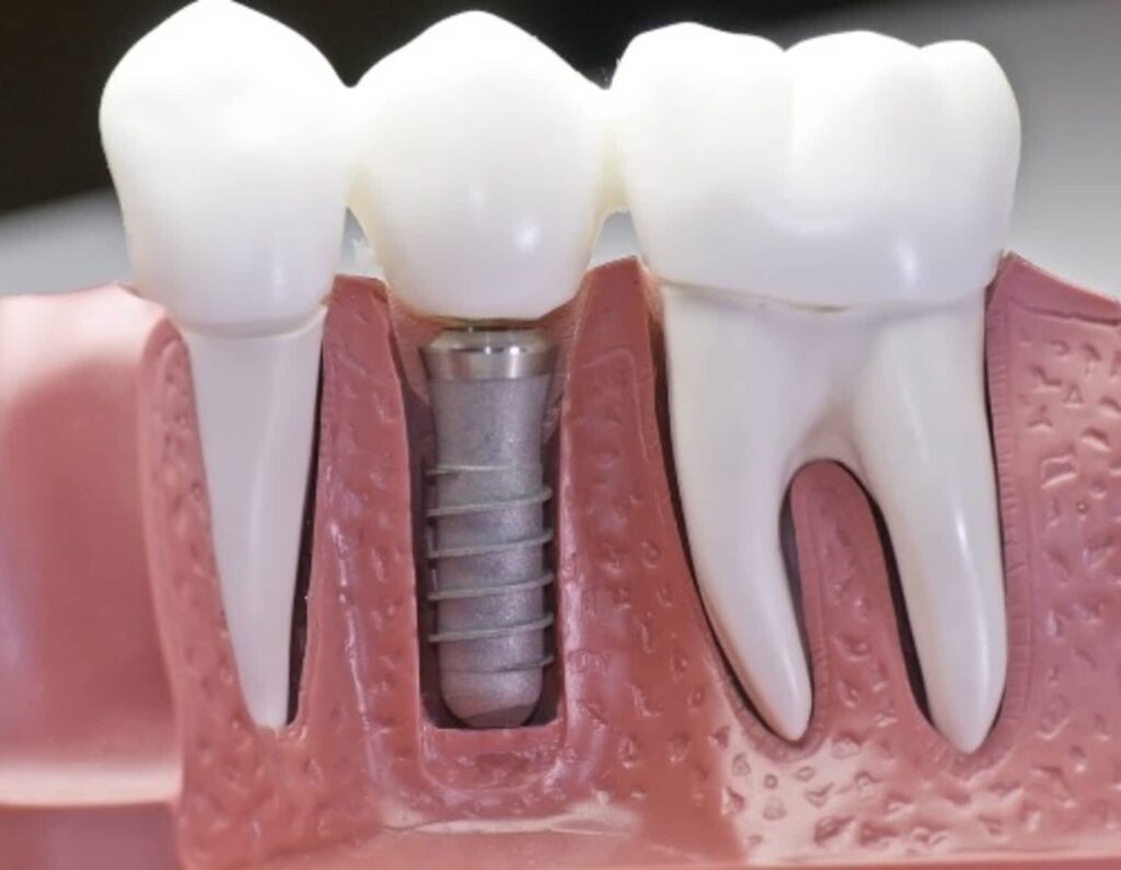 michel-puertas-denturologiste-3.jpg
