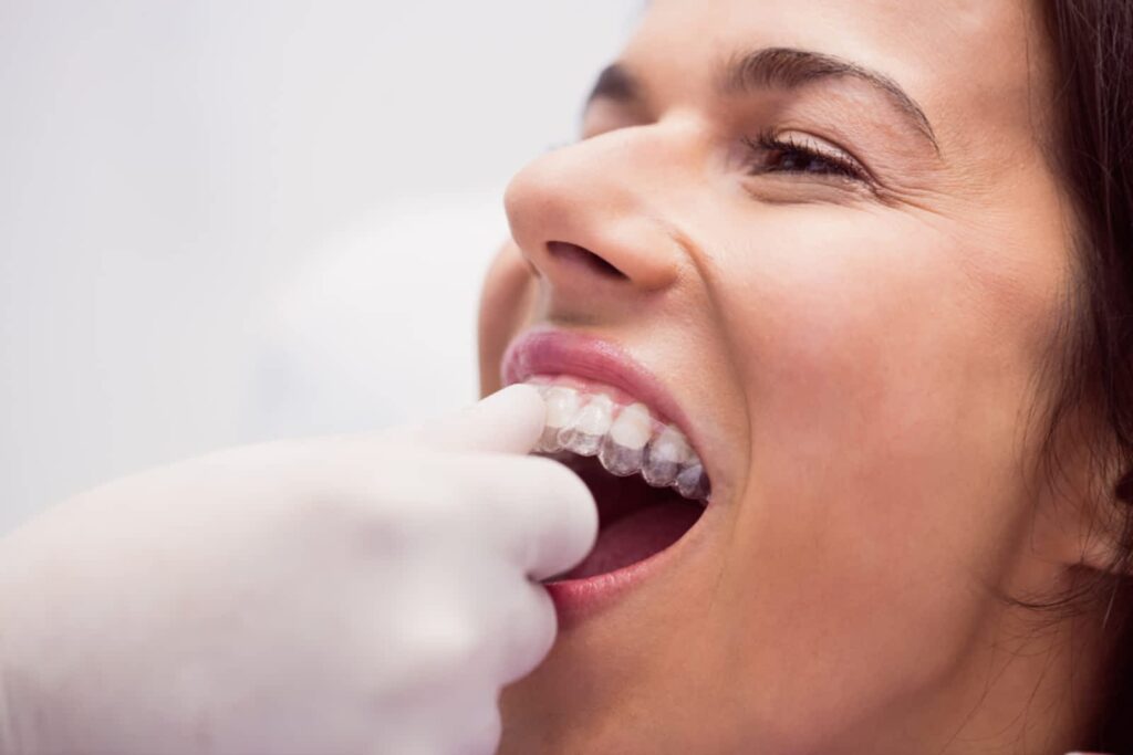 ottawa-smiles-family-dental-1.jpg