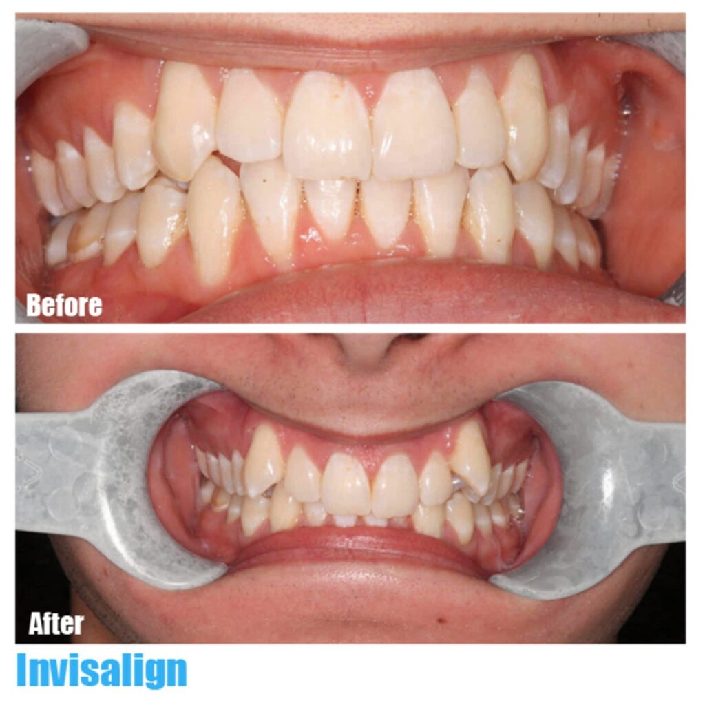simon-fraser-dental-centre-1.jpg