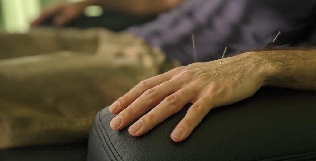 access-acupuncture-1-1.jpg