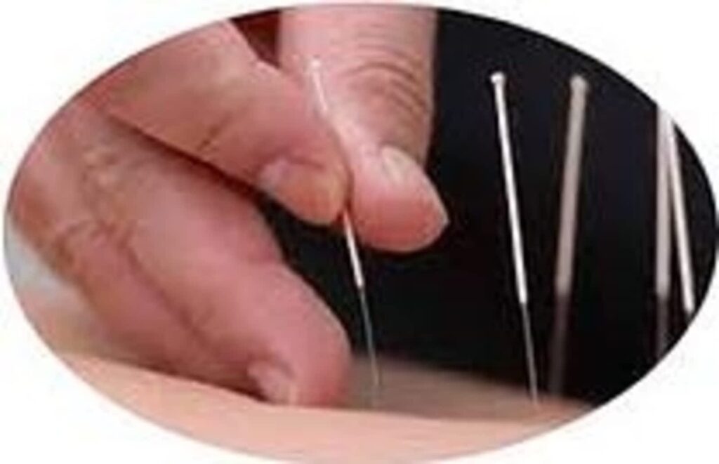 acupuncture-chinoise-a-montreal-zhifang-lily-zhai-1-1.jpg