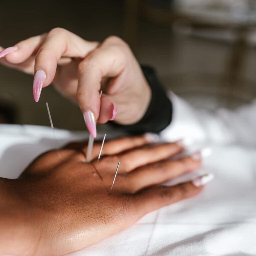acupuncture-for-better-health-1.jpg