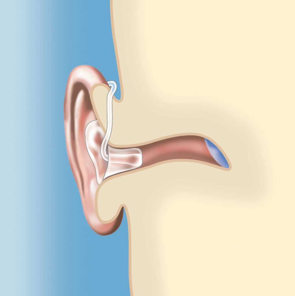 le-reseau-vos-oreilles-1.jpg